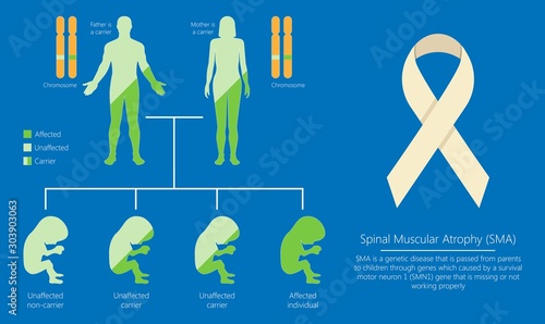 Spinal muscular atrophy SMA genetic disorder