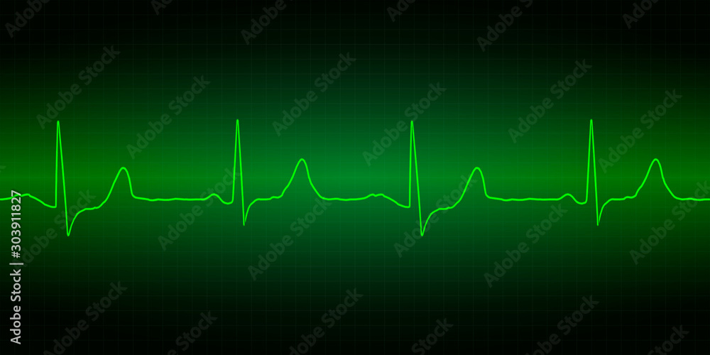 Heart cardiogram  of healthy heart in neon colors.