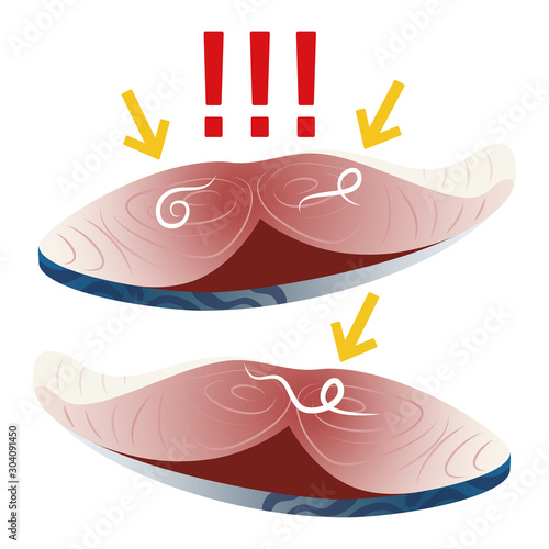 寄生虫 アニサキス と 鯖の切り身 ベクター イラスト