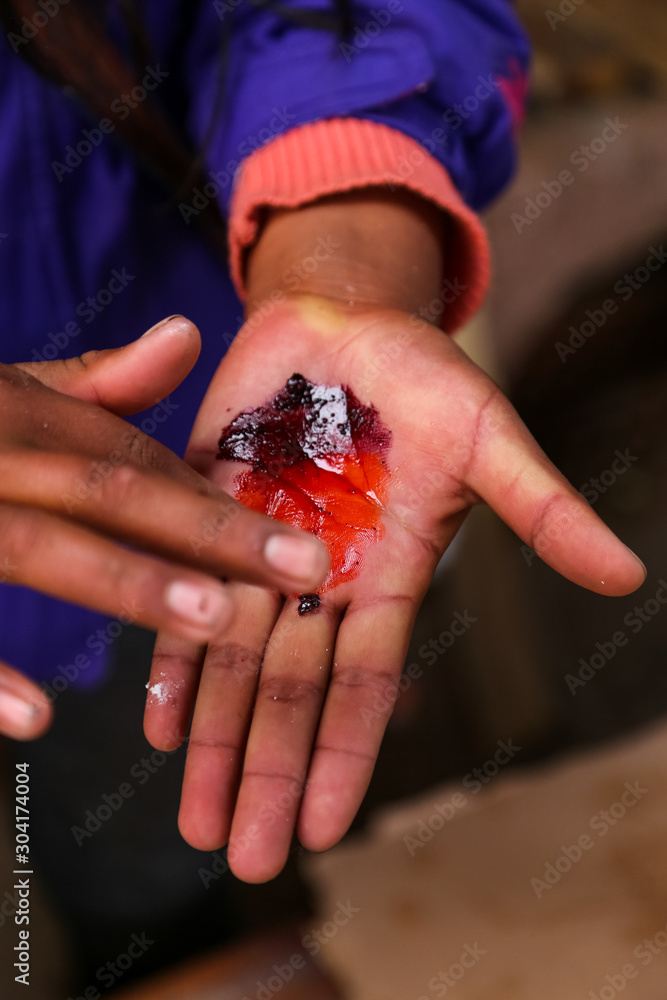 Natural dyeing - cochineal.