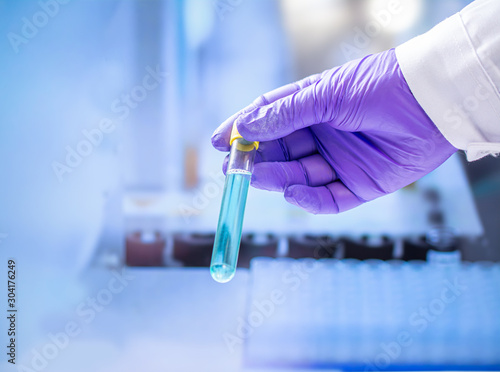 Bacteria test on laboratory test tube in the analysts hand in a plastic glove