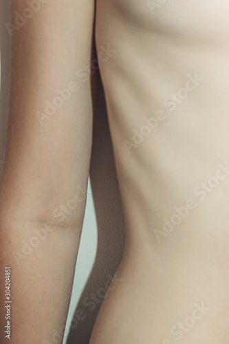female body without face-legs and waist with little visible natural defects on white background