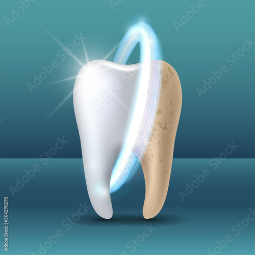 Clean and dirty tooth before and after whitening