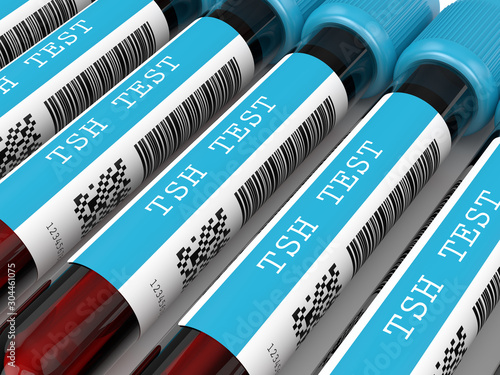 3d render of TSH test blood tubes in row photo