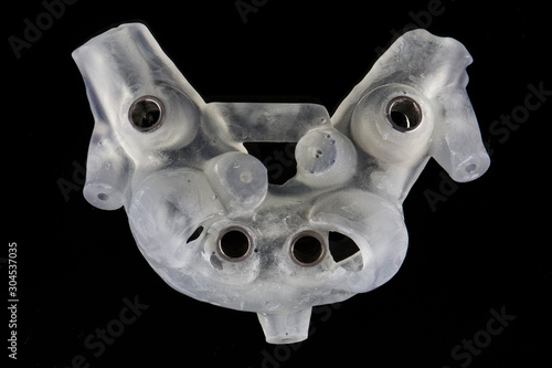 high-quality dental surgical template for four implants, top view on black glass