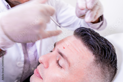 Caucasian man undergoing beauty spa botulinum neurotoxin Botox treatment for anti-aging, to smooth wrinkles as a cometic solution. Injecting forehead to relax muscles with a non-invasive procedure.