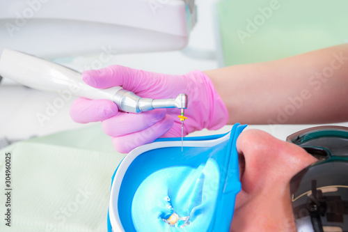 Close-up picture of dental instruments: drill and needle for root canal treatment and pulpitis in hand at the dentist in a pink glove photo