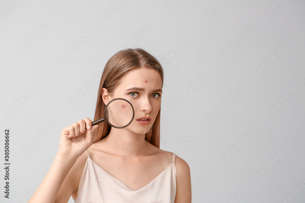 Portrait of young woman with acne problem and magnifier on light background Portrait of young woman with acne problem and magnifier on light background