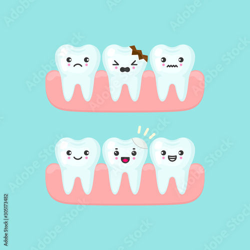 Dental filling on a broken tooth stomatology concept. Cute cartoon vector teeth isolated illustration