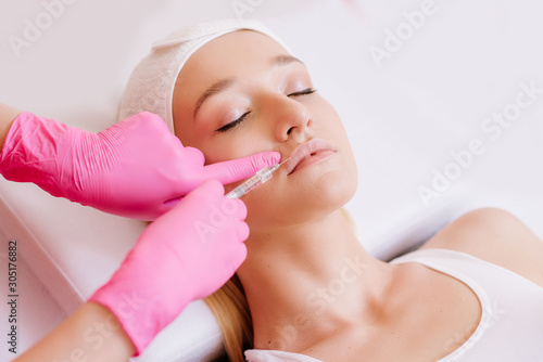 Contour plasticity of lips, augmentation of lips, introduction of filler of hyaluronic acid on woman in SPA center