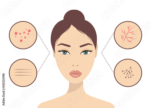 Woman face with problem skin on a white isolated background. Skin problems and care, cosmetology concept. Acne, wrinkles, black spots, vessels on the face vector illustration