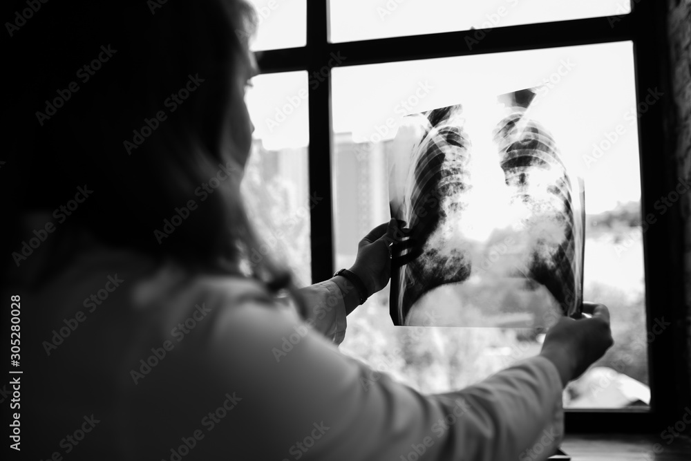 The doctor holds in his hands a picture of his patient’s lungs and looks at the lumen opposite the window.