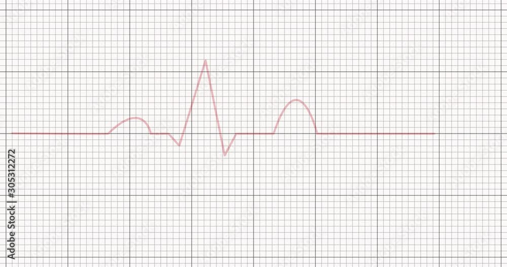 Graphic of heart beat Graphic of heart beat