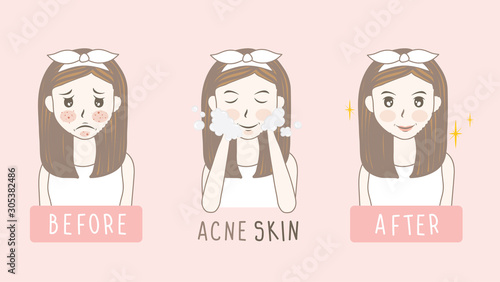 vector woman face. acne before and after. skin care illustration.