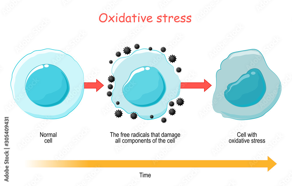 Oxidative Stress. Vector diagram Cell with free radicals. Stock Vector ... Biology Diagrams