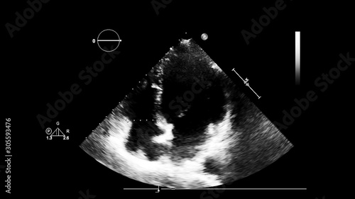 Screen of an ultrasound machine with a heart image. © faustasyan