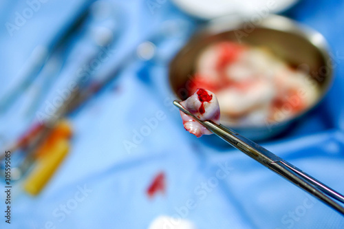 Close up image of medical scissor picking up a part umbilical cord piece of baby for abnormal detection with blurry background of umbilical cord piece of baby in a medical bowl and surgical equipment. © Atiwat