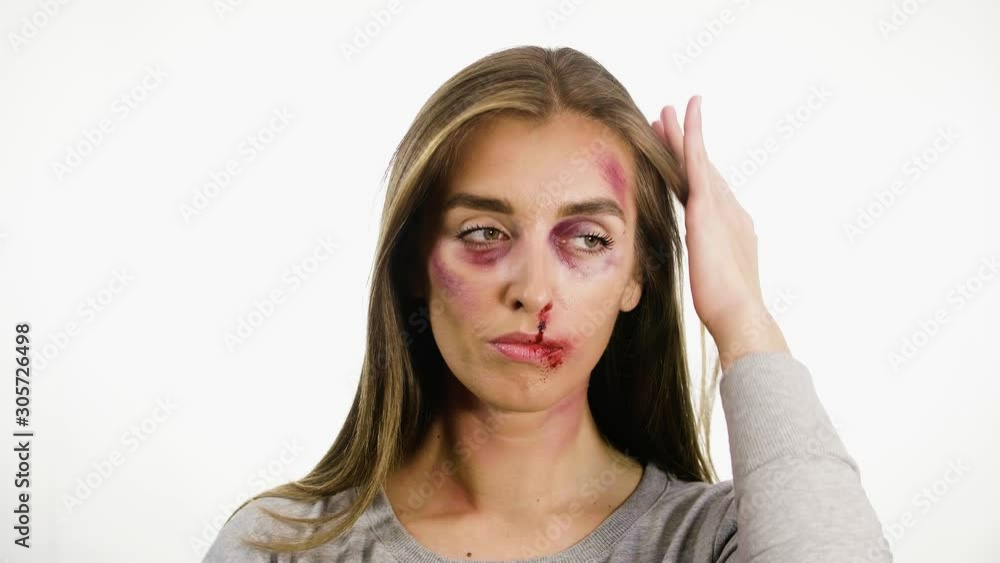 portrait of a woman on a white background, with traces of domestic violence, bruises of a sadina, nosebleed lips, a girl posing and looking to the side portrait of a woman on a white background, with traces of domestic violence, bruises of a sadina, nosebleed lips, a girl posing and looking to the side