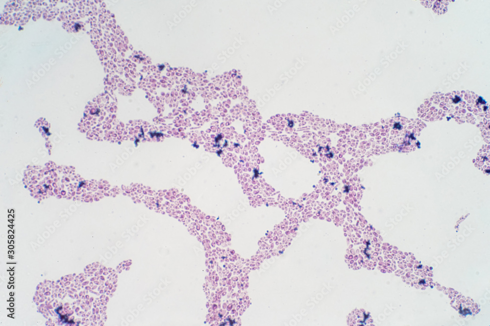 How Do Yeasts Reproduce Asexually