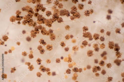 Bread mold fungi under microscope for education.