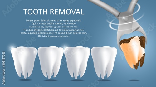 Tooth removal vector medical poster banner template
