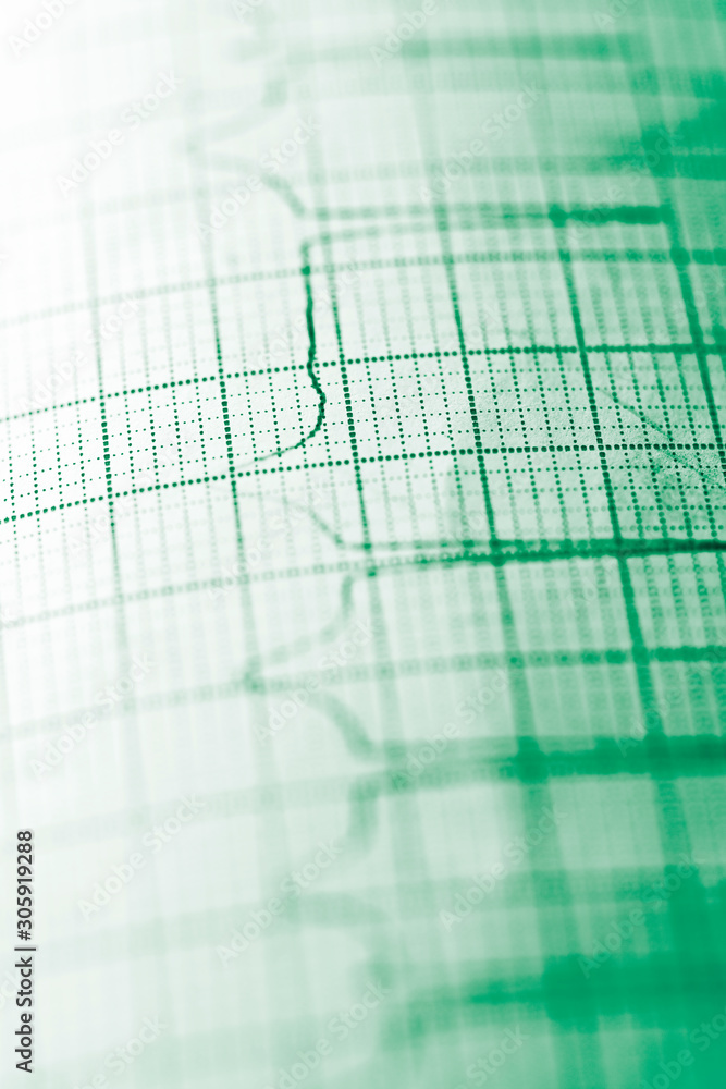 Electrocardiogram close up Electrocardiogram close up