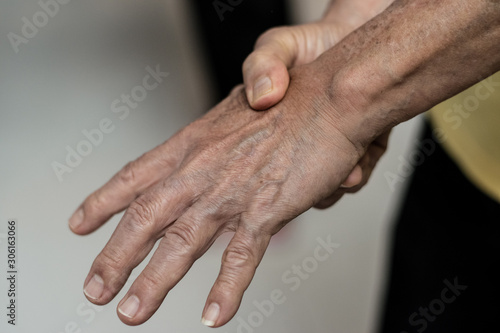 Fototapeta Naklejka Na Ścianę i Meble -  Overuse hand problems. Woman’s hand with red spot o fingers as suffer from Carpal tunnel syndrome. The symptoms of tingling, numbness, weakness, or pain of the fingers and wrist.