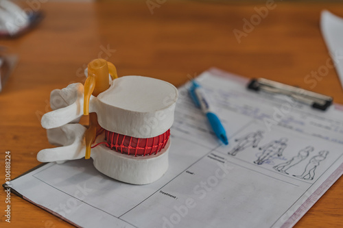 Lumbar spine model on table in Physiotherapy clinic