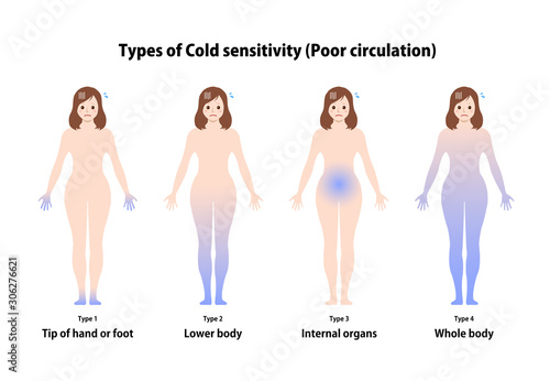 Types of cold sensitivity / poor circulation vector illustration