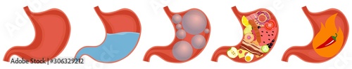 Human Stomach. Empty and full stomach. Bloating.