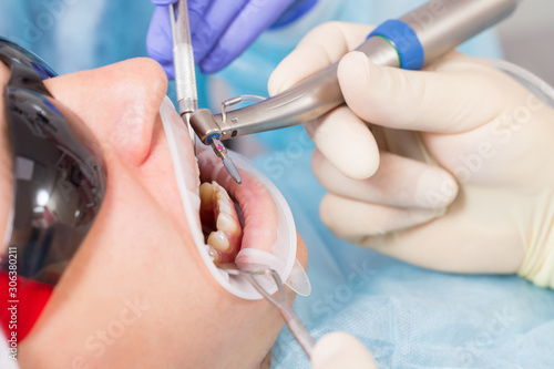 Male patient undergoing implant surgery in a dental clinic. The dentist holds a drill with an implant.