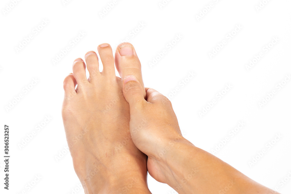 Case of palmoplantar hyperhidrosis, symptomatic sweating of hands and feet on a woman