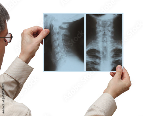 hands of a man holding an x-ray picture frame