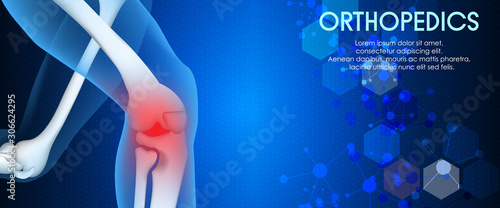 Medical orthopedic abstract background. Treatment for orthopedics traumatology of knee bones and joints injury. Medical presentation, hospital. Vector illustration