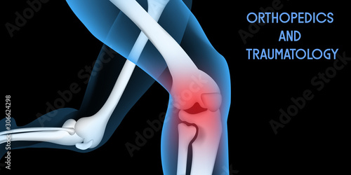 Medical orthopedic abstract background. Treatment for orthopedics traumatology of knee bones and joints injury. Medical presentation, hospital. Vector illustration