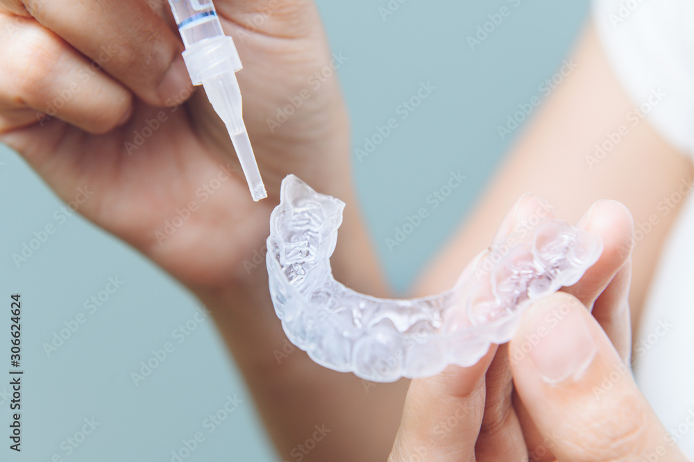 Tooth whitening gel being applied to a tooth mold in preparation for