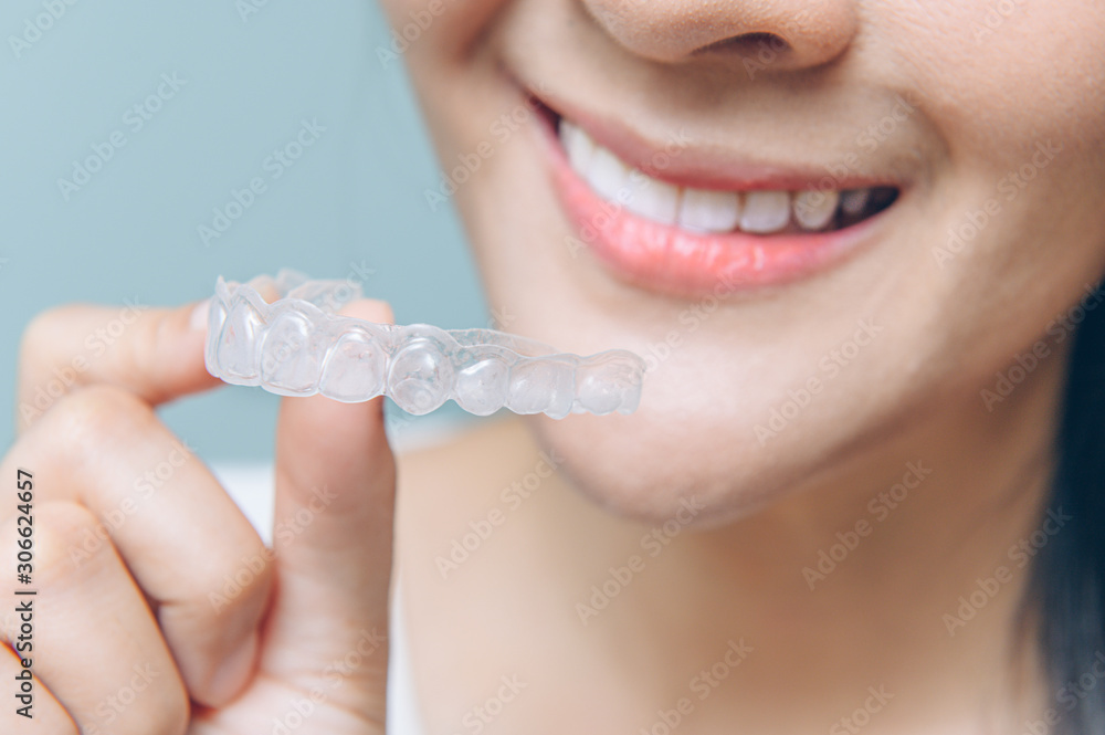 © Varangkana - close up mouth of Woman holding orthodontic silicone. Mobile orthodontic appliance for dental correction.