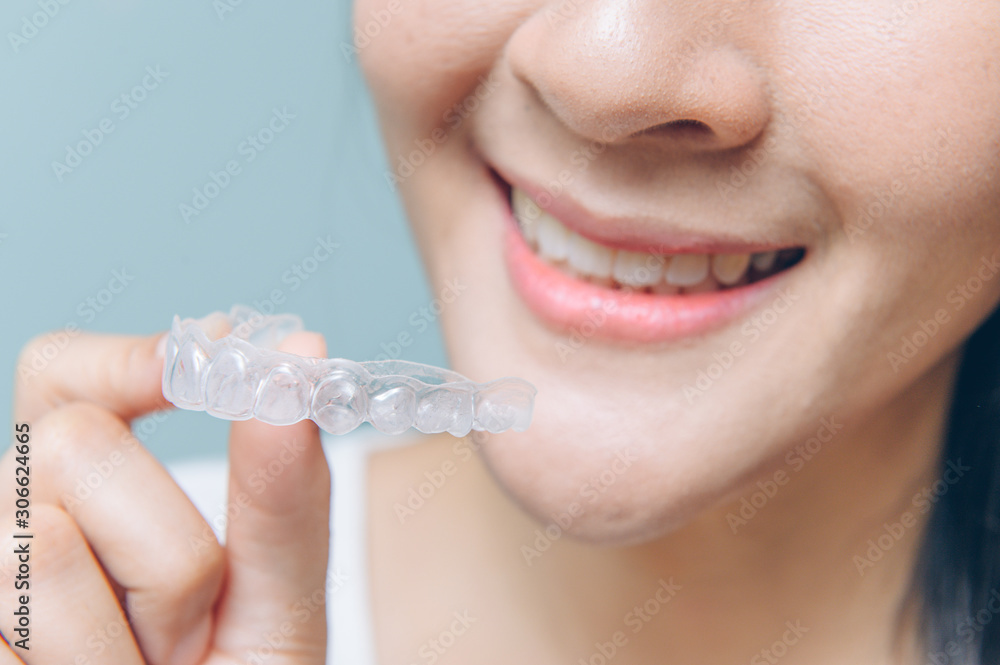 close up mouth of Woman holding orthodontic silicone. Mobile orthodontic appliance for dental correction. close up mouth of Woman holding orthodontic silicone. Mobile orthodontic appliance for dental correction.
