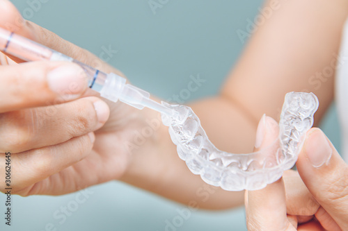 Tooth whitening gel being applied to a tooth mold in preparation for being placed in the mouth. photo