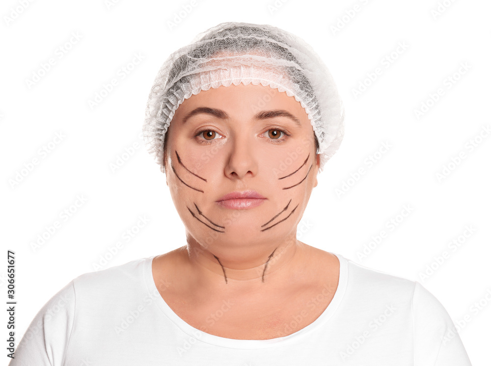 Woman with double chin ready for cosmetic surgery operation on white background Woman with double chin ready for cosmetic surgery operation on white background