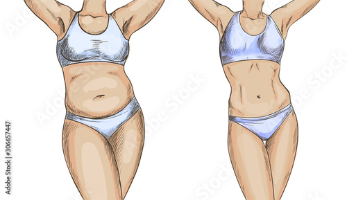Before after collage with female body, weight loss
