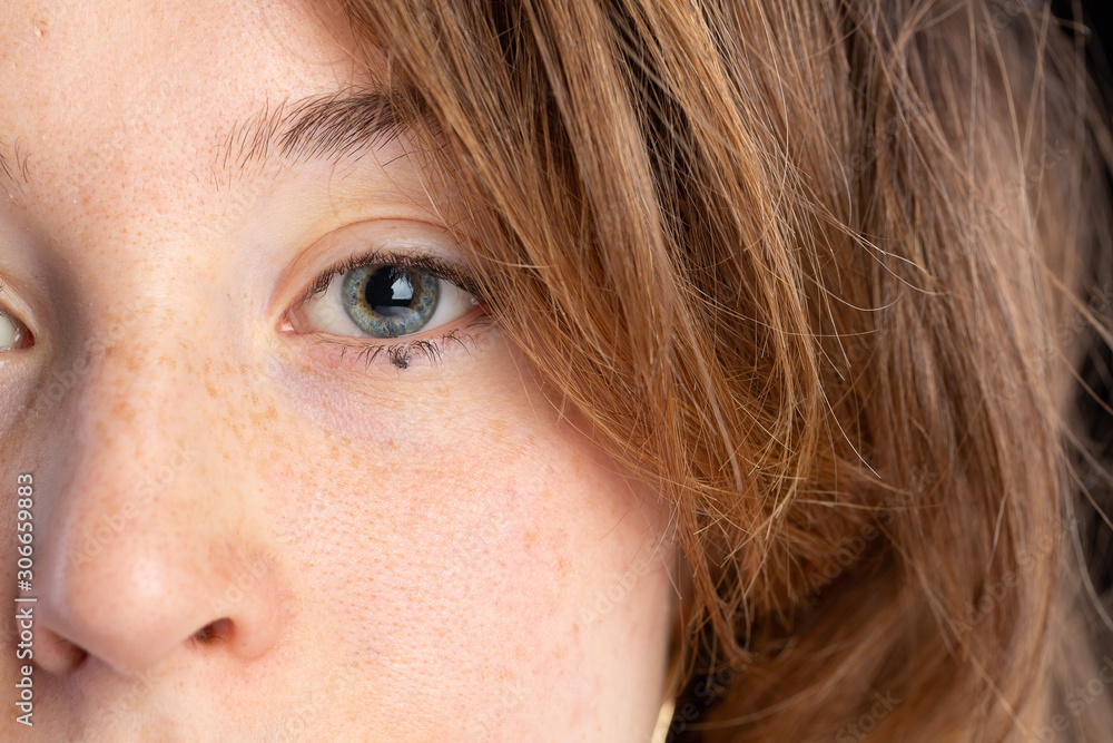 close-up of blue eye, hair and freckles of a white girl close-up of blue eye, hair and freckles of a white girl