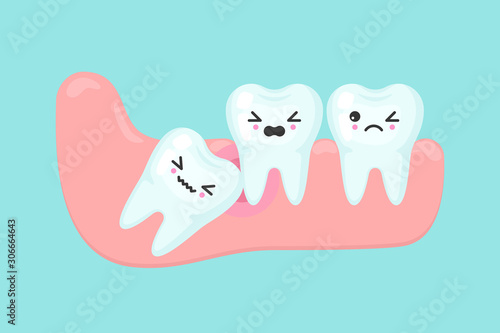 Wisdom tooth problems dental stomatology vector concept. Impacted tooth inside under inflammation gum