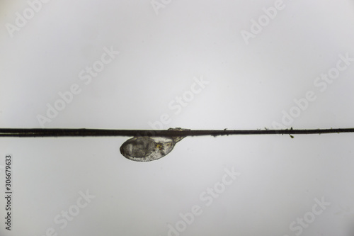 an egg lice glued to the hair, a photograph taken with the aid of a microscope 