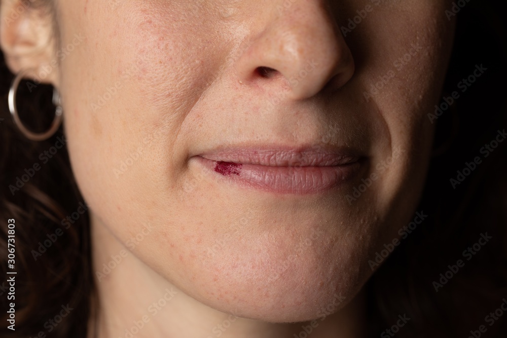 Detail of a girl's face facing left with a smear of lipstick on her lower lip Detail of a girl's face facing left with a smear of lipstick on her lower lip
