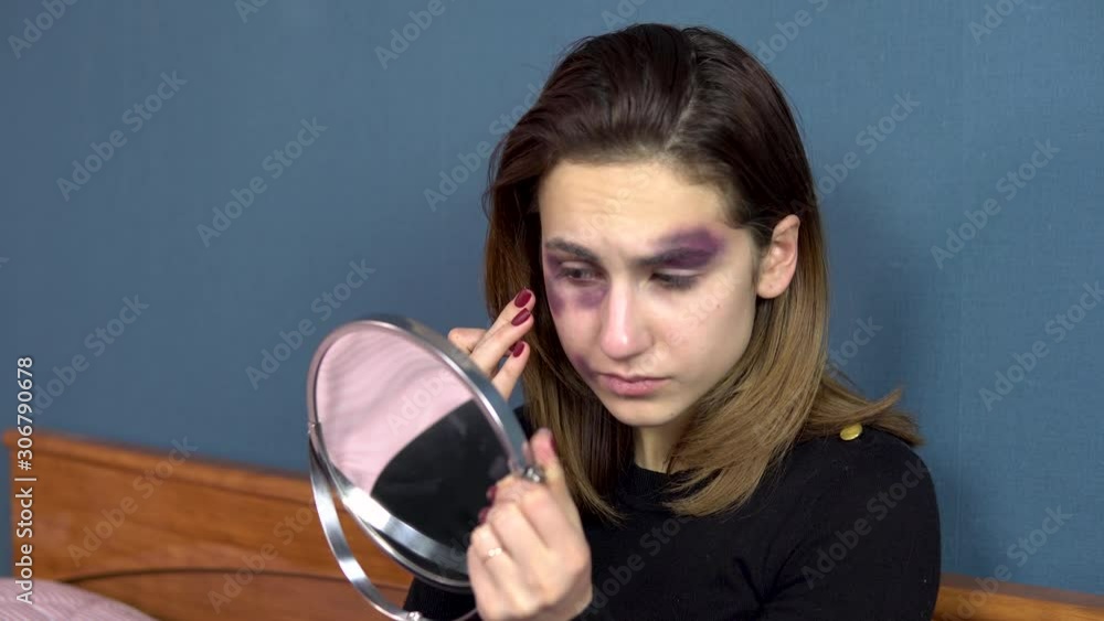 A young woman examines bruises on her face in the mirror. Quarrels in a