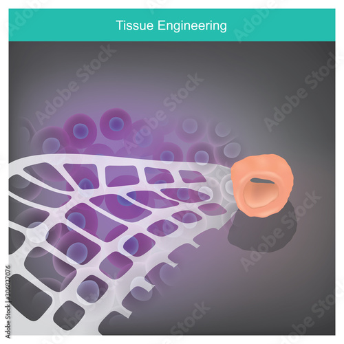 The cells are extracted from the tissues of patients, and that bring cells were cultured in the scaffold plate to increase the amount, After that the cells must change to tissue on body respond..