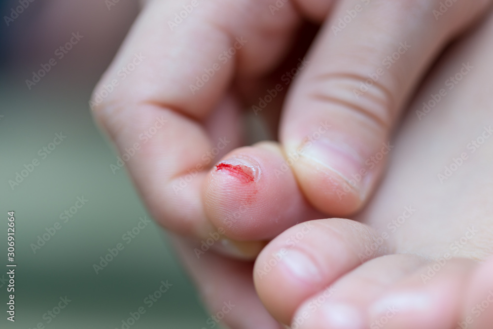 mom cuts baby's nails with protective scissors mom cuts baby's nails with protective scissors