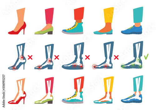 Different types of shoes and their ergonomic. High heel, mid heel, flats, sneakers, sports shoes. Right and wrong foot support.