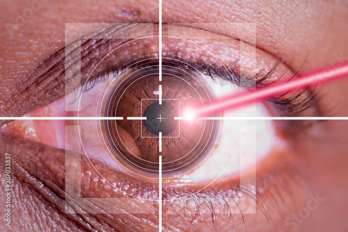laser or lasik eye surgery concept, l laser beam shining into african america male dark brown eyes photo